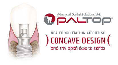 ARISTON Paltop – Concave Design από την αρχή έως το τέλος