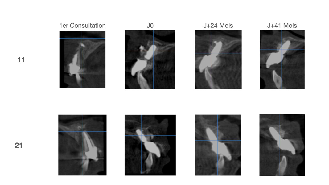 Fig. 22