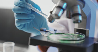 Study reveals a potential new target for periodontal disease treatment