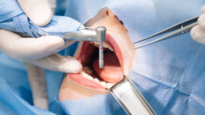 CleanImplant Foundation fights for contaminant-free dental implants