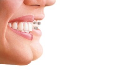 Invisalign opens first dedicated dental centre in Dubai