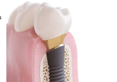Solving clinical challenges with new treatment solution from DENTSPLY Implants