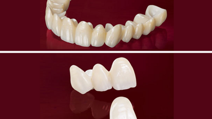 Los avanzados productos de zirconia de Glidewell ya están en Latinoamérica