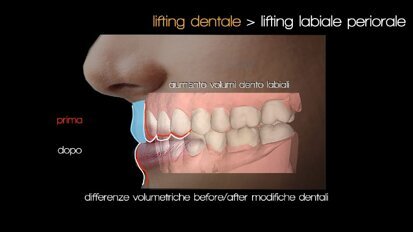 Logopedia Estetica Funzionale: quali sinergie con l’odontoiatria e la medicina estetica?
