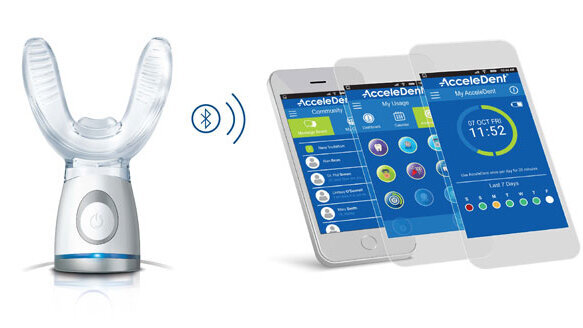 OrthoAccel’s new AcceleDent Optima receives FDA clearance