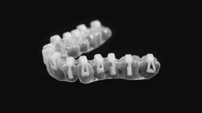 Rivoluziona il modo in cui crei gli attachments per allineatori!