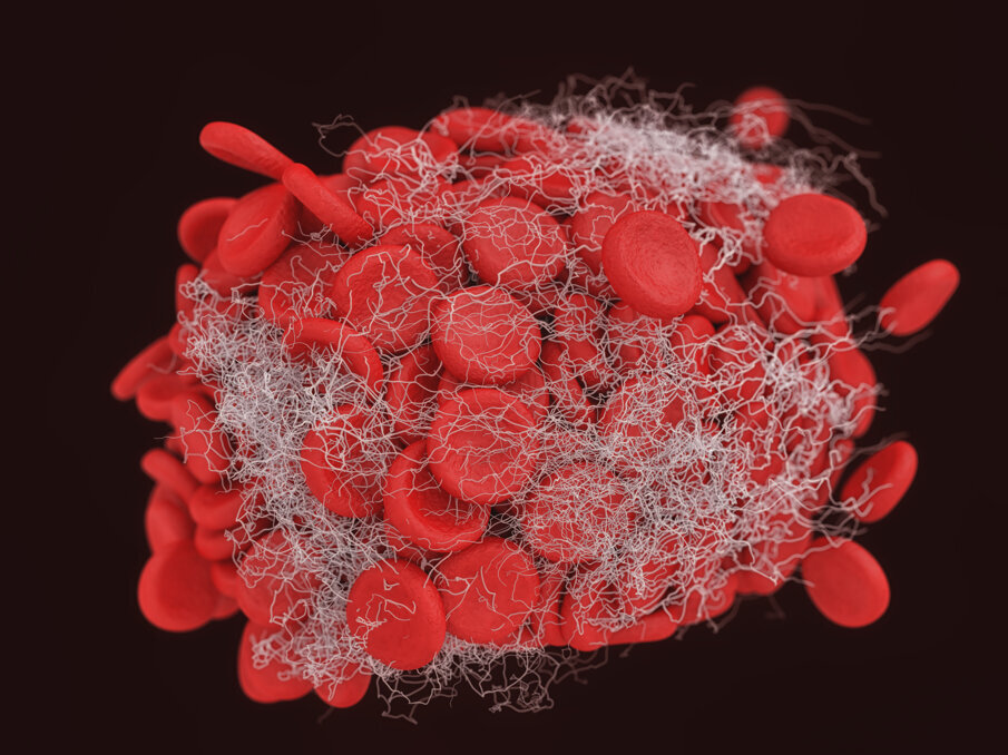 Fig. 3 - Piastrine aggregate in un coagulo (Shutterstock).
