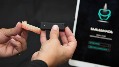 Introducing SmileShade: Revolutionising dental shade identification and communication