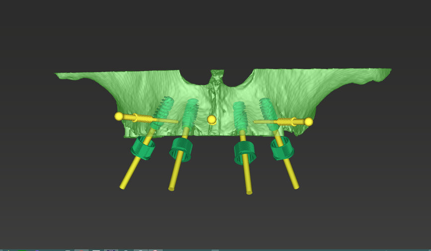 Fig. 7