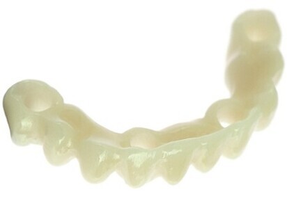 Immediate Smile bridge gives patients and dentists something to smile about