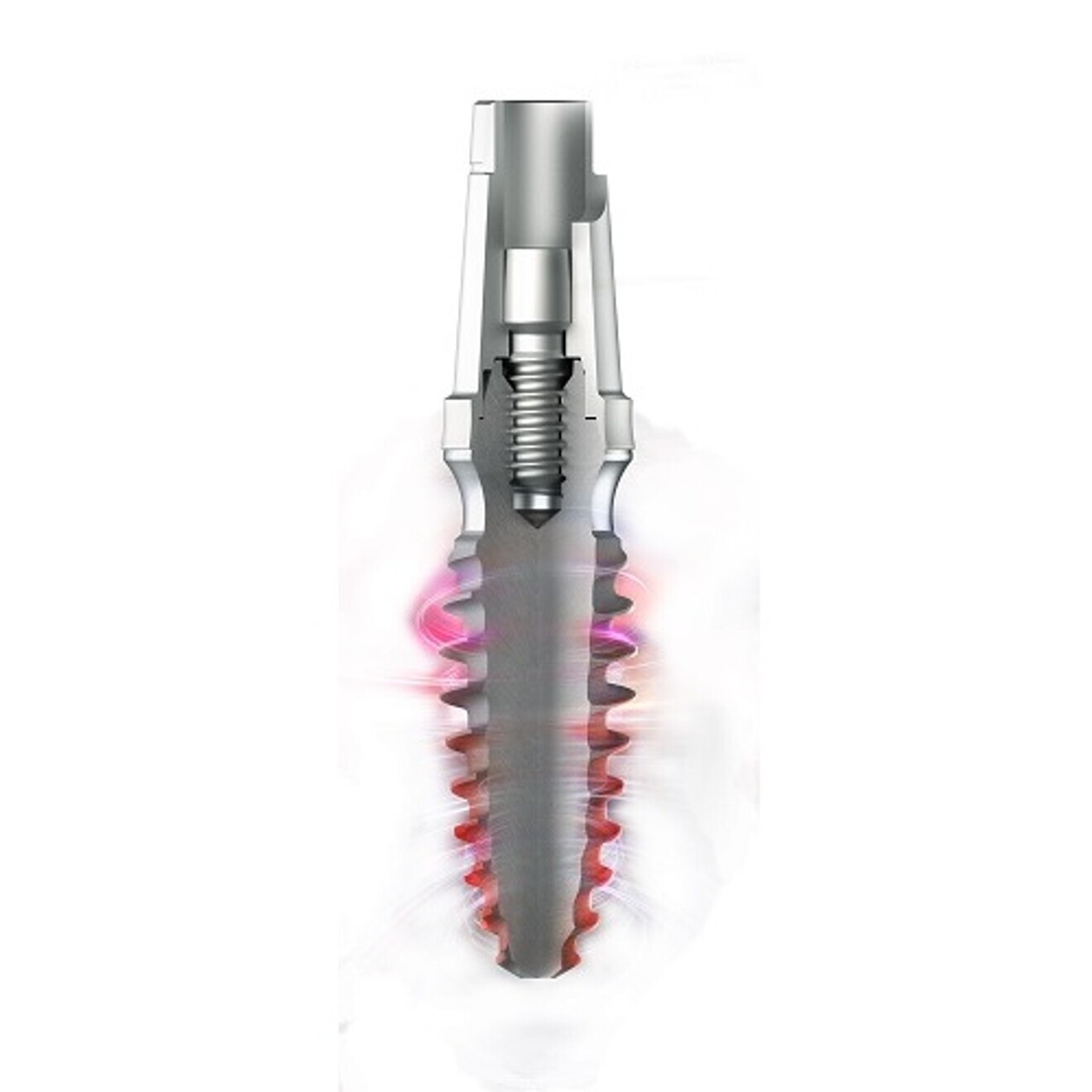 The bright tissue-level implant.