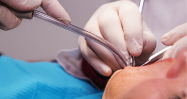 Periodontitis could increase stroke risk, new study says