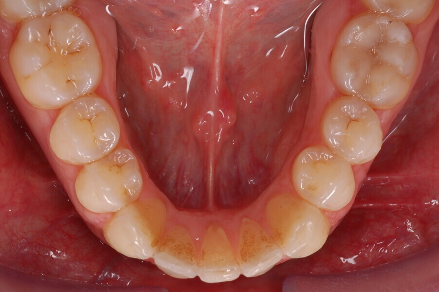 Fig. 44.