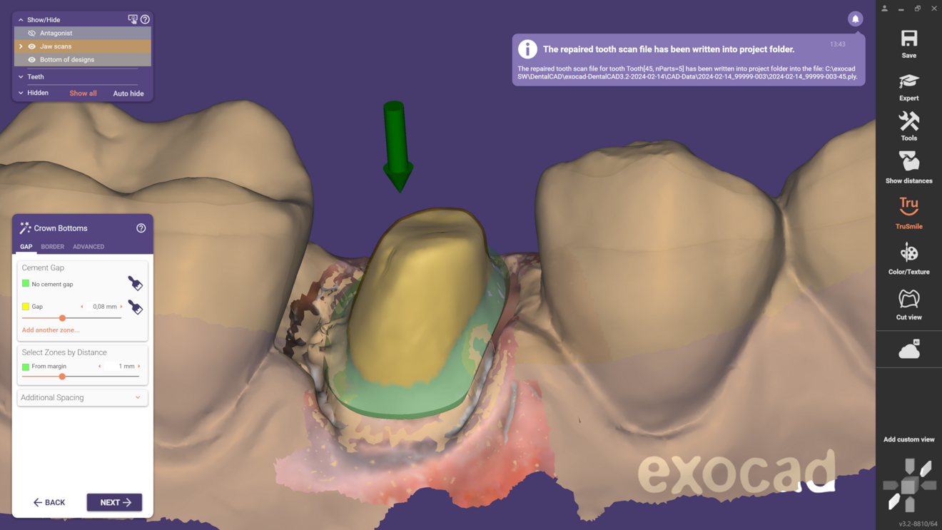 Fig. 3: The modified preparation is saved as a single file and will automatically load with the case in the future. This ensures that any corrections, such as those made by a master dental technician before passing the case to another technician, are retained. The original scan data remains available and visible for reference.