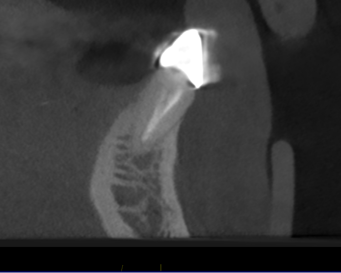 Fig. 2c.