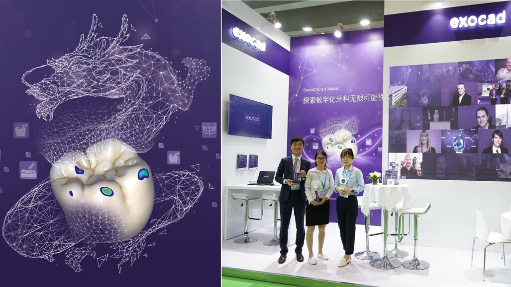 Exocad giới thiệu các giải pháp phần mềm mới nhất tại triển lãm Dental South China