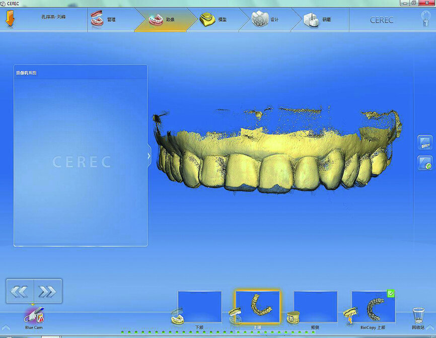 Fig. 12: Pre-operation scan.