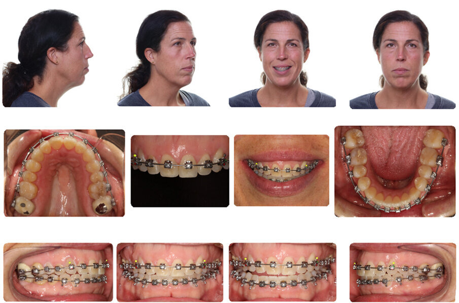 Phase 2
