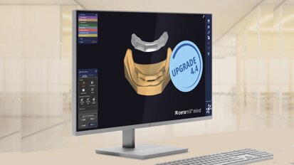 Ceramill 4.4: más eficiente y más indicaciones 
