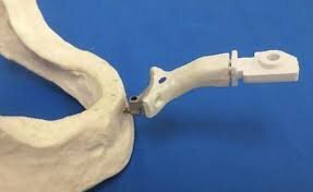 Figg. 5a-5f - I differenti protocolli d’intervento supportati dal sistema Navident by Claronav. Per sopperire ai diversi scenari clinici ci si può ritrovare ad affronta in chirurgia implantoprotesica; navistent nel paziente edentulo con ancoraggio orizzontale (a) e verticale (b); c) navistent nel paziente non edentulo;  Trace and Place composto da Tracer (d) in associazione a Jaw Tracker (e) o Head Tracker (f) (quest’ultimo solo per l’arcata superiore).