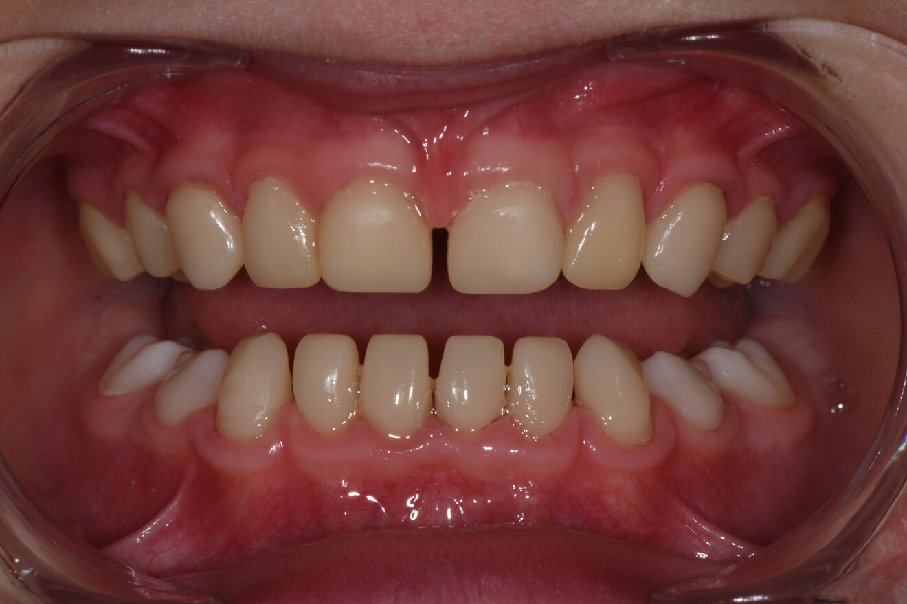 Fig. 8d