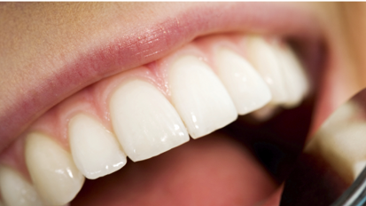 Il valido contributo dell’igienista dentale nell’individuazione del cancro orale