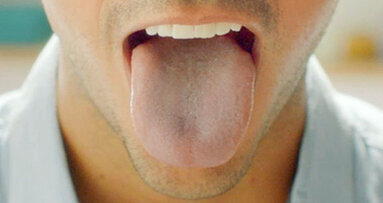 Causes and treatment of breath odour