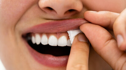Hiệp hội Nha khoa Đan Mạch lo lắng về thiệt hại không thể phục hồi do sử dụng snus