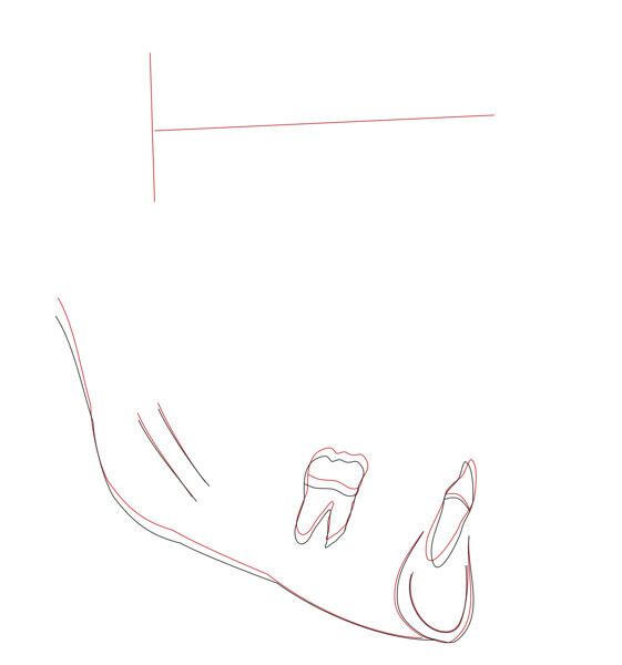 Fig. 48