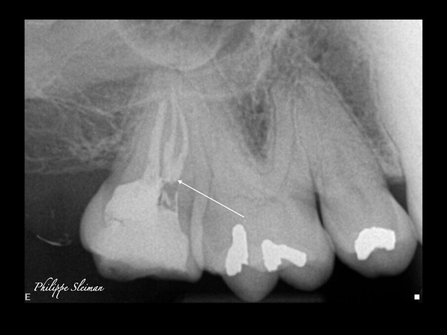 Fig. 15