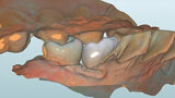 Fig. 9. Vista lingual del diseño.