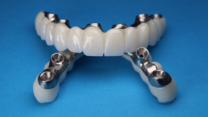 China to balance quality and price in bulk dental implant bids