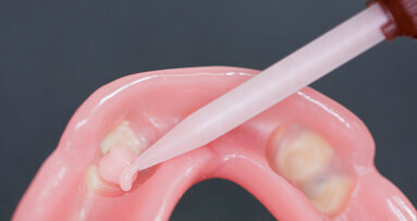 New Quick Up method eliminates risk of accidental locking of dentures, cuts procedure time in half