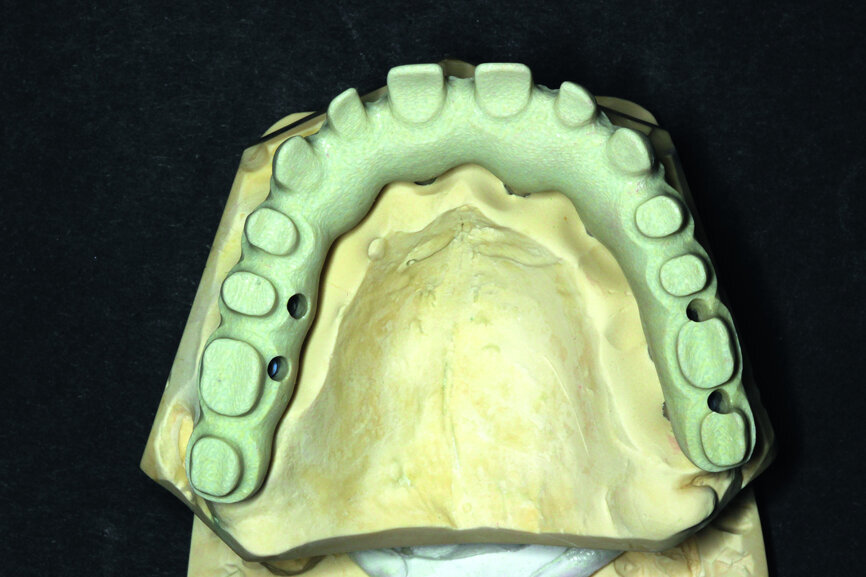 Fig. 11: Suprastructure cut out and transferred onto the model.