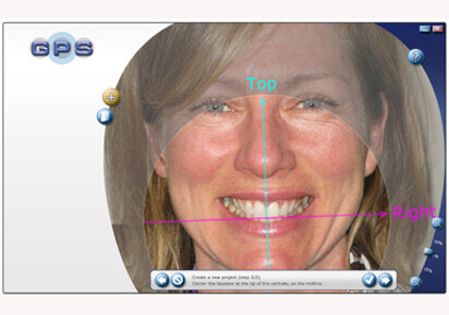 The facebow goes digital