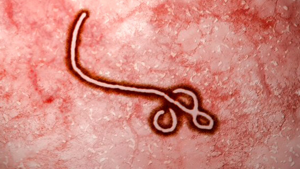 Preporuke za stomatologe u vezi sa širenjem ebola virusa