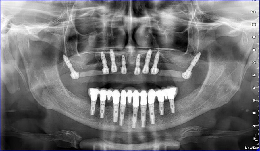 Fig. 8