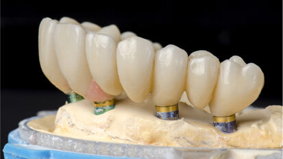 Straumann Campus broadcasts three online webinars on current implant treatments