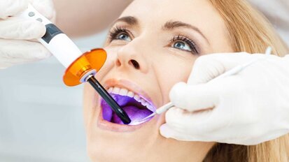 UV-Licht: Neuer Ansatz für verbesserte Implantatinsertion