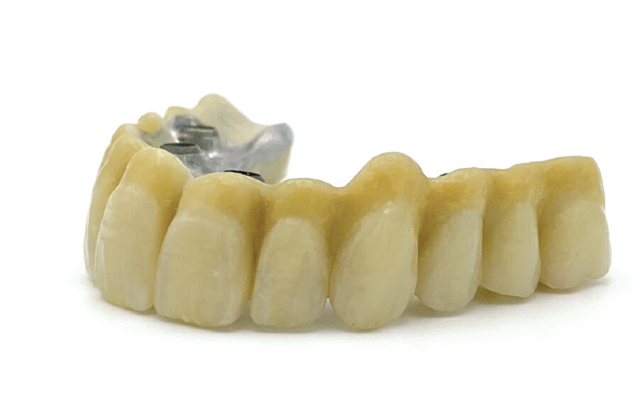 Fig. 11 - Protesi definitiva pronta per la consegna.