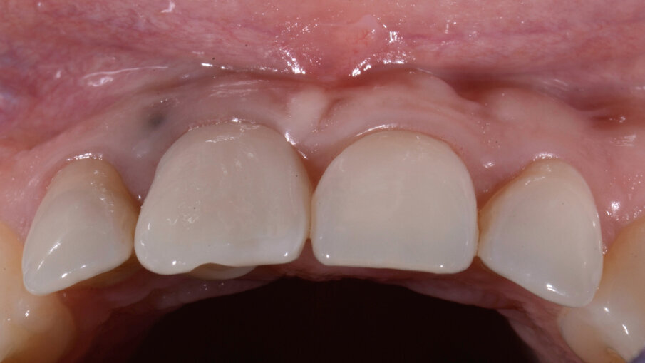 Fig. 37_1 anno b.