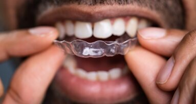 Periodontal considerations in aligner treatment