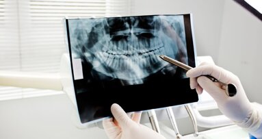 Developmental dental anomalies in offspring linked to consanguineous marriages, study finds