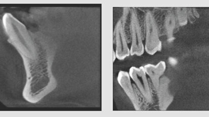Suni Medical Imaging announces 3-D-only cone beam system