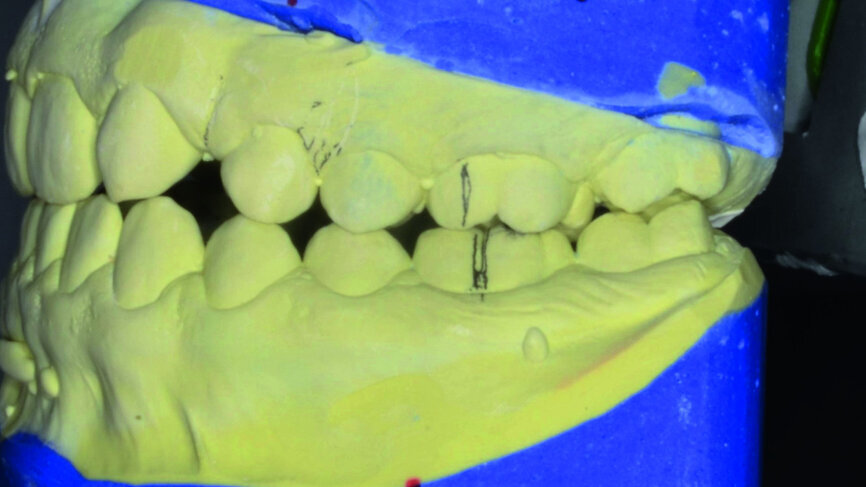 Fig. 21
