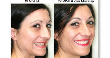 Diseño de sonrisa y neuromarketing