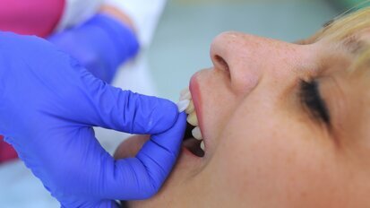 Alerta sobre el turismo dental en Marruecos