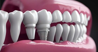 „Ceramic Implants meets Aesthetics“ im Mai in München