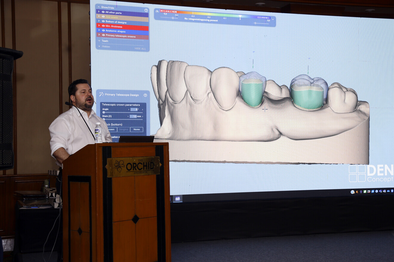 Zoran Hinic. Head of Dental lab at Bredent.