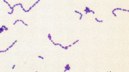 Rol van mondbacteriën bij endocarditis in kaart gebracht